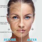 2x1 Reafirma y Reduce tu Papada y Arrugas - Serum Botox con Colageno